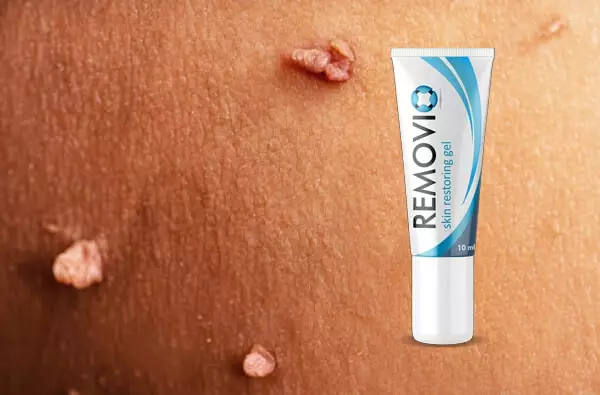 Qu'est-ce que le gel Removio ?