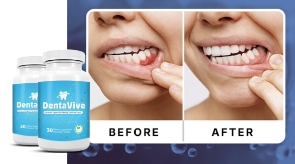 Comment utiliser Dentavive